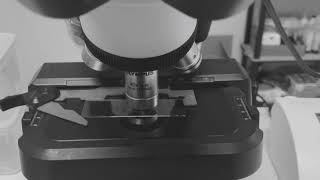 Urine Sediment Cell Identification Clinical Microscopy 🔬🦠 [upl. by Ardnasxela]