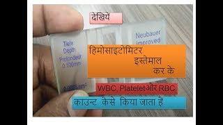 Hemocytometer manual a complete solution for RBCWBC and Platelet count practically based in Hindi [upl. by Eylk]