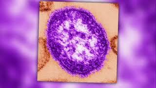 Health department warns of measles outbreak in Philadelphia [upl. by Eidualc]