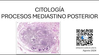 Citología de “Mediastino Posterior” [upl. by Aitercul]