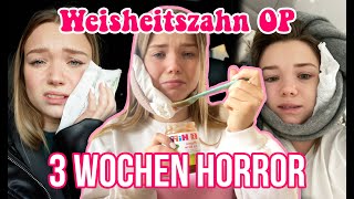 Meine Weisheitszahn OP AN WEIHNACHTEN und der extreme Horror danach [upl. by Carrew]