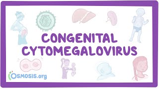 Congenital CMV  causes symptoms diagnosis treatment pathology [upl. by Enyaz]