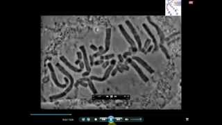 Real Microscopic Mitosis  MRC [upl. by Eiduj]