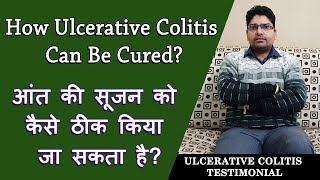 How Ulcerative colitis can be Cured  अल्सरेटिव कोलाइटिस को कैसे ठीक किया जा सकता है [upl. by Nilam976]