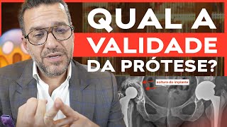 Qual é a Validade da Prótese de Quadril Ela VENCE Antes e Depois da Cirurgia [upl. by Peednus891]