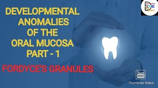 DEVELOPMENTAL ANOMALIES OF THE ORAL MUCOSA PART 1 FORDYCES GRANULES [upl. by Eeliak]