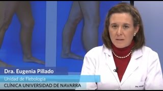 Escleroterapia con microespuma para eliminar varices [upl. by Schonthal]