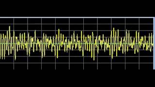 Infections  Rife Frequencies [upl. by Neelear]