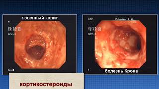 Месалазин  характеристика механизм действия при ВЗК © Mesalazine  characteristics [upl. by Giulio]