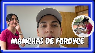 QUEMADURAS CONTROLADAS para eliminar las MANCHAS DE FORDYCE I JAVIER DERMA [upl. by Jayson918]