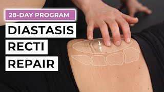 28Day Diastasis Recti Repair Program FREE Challenge [upl. by Maddalena]