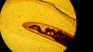 Trichuris trichiura female [upl. by Hniht]