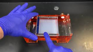 Agarose Gel Electrophoresis [upl. by Antonia525]