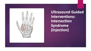 Ultrasound Guided Interventions Intersection Syndrome Injection ultrasound [upl. by Yanaj]