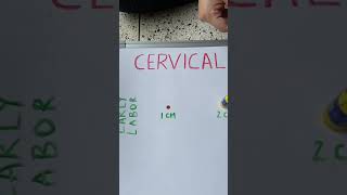 Cervical Dilation during Labor [upl. by Syd]