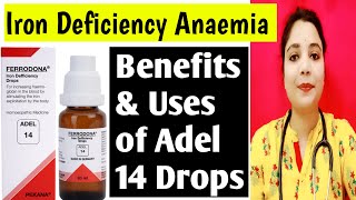 Adel 14  Iron Deficiency Anaemia  Homeopathic Medicine for Anaemia  By DRDEEPTI MAHURE [upl. by Acinorav]