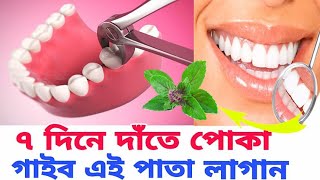 date poka lagle ki korbo  date poka valo korar upay  teeth poka [upl. by Akienat167]