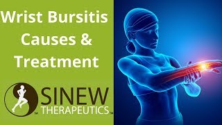 Wrist Bursitis Causes and Treatment [upl. by Neras]