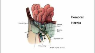 femoral triangle [upl. by Adnyl]