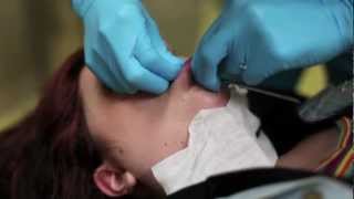 6g labret piercing procedure [upl. by Agnot379]