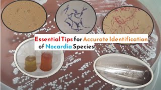 Essential Tips for Accurate Identification of Nocardia Species [upl. by Atikehs]