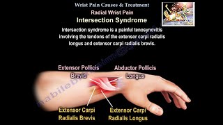 Wrist Pain Causes amp Treatment  Everything You Need To Know  Dr Nabil Ebraheim [upl. by Nyladnarb]