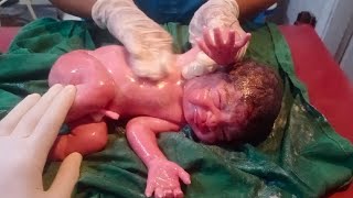 New born baby very small but not so active cleaning done with baby oil vernix removed ❣️ [upl. by Eimarej426]