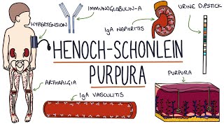 HenochSchonlein Purpura Visual Explanation for Students [upl. by Nahtanaj572]