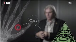 EL MICROCHIP en pocos años TODOS lo llevaremos implantado [upl. by Trefler]