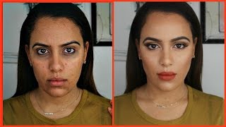 Como Cubrir Acne Manchas Ojeras con CORRECTORES DE COLORES  MUY FACIL 2017 [upl. by Ailiec]