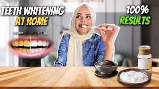 Teeth Whitening At Home  Guaranteed Results  No More Yellow Teeth  Dietitian Aqsa [upl. by Ishii]