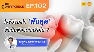 The Convergence EP102  ไขข้อข้องใจ ‘ฟันคุด’ จำเป็นต้องผ่าหรือไม่ [upl. by Tessi]