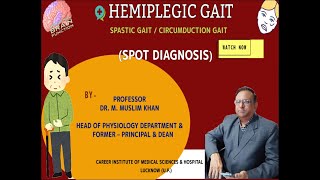 NS17Hemiplegic Gait  Spot DiagnosisFeaturesTypesSites of Lesion of HemiplegiaDr Muslim Khan [upl. by Dahc]