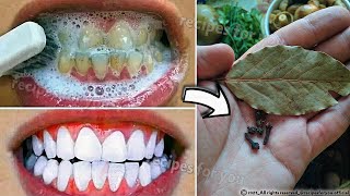 Secret that Dentists dont want you to know Remove Tartar and Teeth Whitening in just 2 minutes [upl. by Hassett]