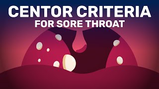 Is Your Sore Throat Caused by Bacterial Infection or Viral [upl. by Shevlo]