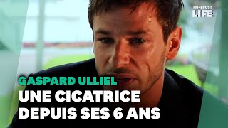 Gaspard Ulliel et sa cicatrice lhistoire derrière cette marque qui faisait quotpartie de luiquot [upl. by Fatima]