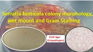 Serratia fonticola colony morphology wet mount and Gram Staining [upl. by Himelman]