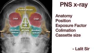 PNS xRay in hindi [upl. by Uaeb510]