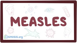 Measles  causes symptoms diagnosis treatment pathology [upl. by Corly]