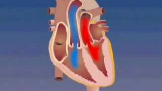 Transposition of the Great Arteries [upl. by Eirellav]