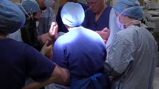 Having a forceps delivery  Understanding Shoulder Dystocia  One Born Every Minute [upl. by Vergil]