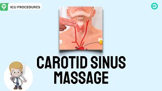 Carotid Sinus Massage What is it and How to perform the procedure [upl. by Erlewine]