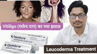 Vitiligo सफ़ेद दाग़ का नया इलाज़ 2024  Vitiligo New Treatment  Ruxolitinib  Leucoderma Treatment [upl. by Treacy22]