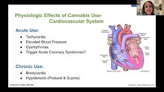 Communicating Cannabis Use Before Surgery [upl. by Eniotna]