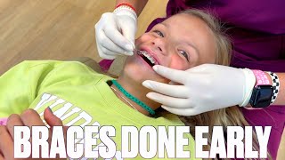 NINE YEAR OLD GETTING BRACES OFF EARLY  HOW TO SHORTEN TIME WITH BRACES [upl. by Wartow]