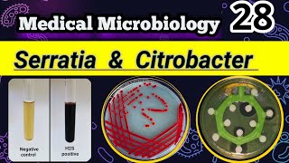 Serratia amp Citrobacter Late lactose Coliforms شرح بالعربي [upl. by Bosson]