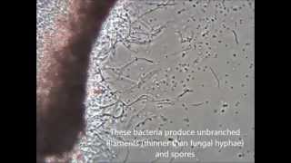 Streptomyces sp [upl. by Bilicki]