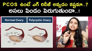 Does PCOSPolycystic Ovarian Syndrome Effects To Release Eggs In Ovaries  Dr Shruthi  Ferty9 [upl. by Dario112]