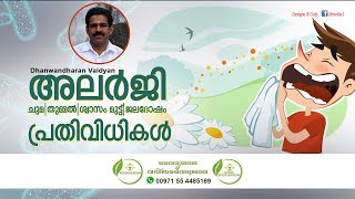 Allergy Malayalam  Allergy Ayurveda Treatment  അലര്‍ജി ഒറ്റമൂലി  Dhanwantharan Vaidyar [upl. by Dyke]