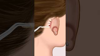 ASMR Infected ear piercing removal animation P1 animation asmr satisfying viral shorts [upl. by Gnoix]